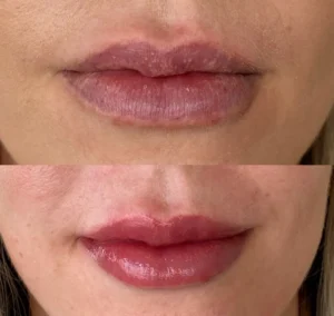 How Lip Tattoos Can Enhance Your Natural Beauty
