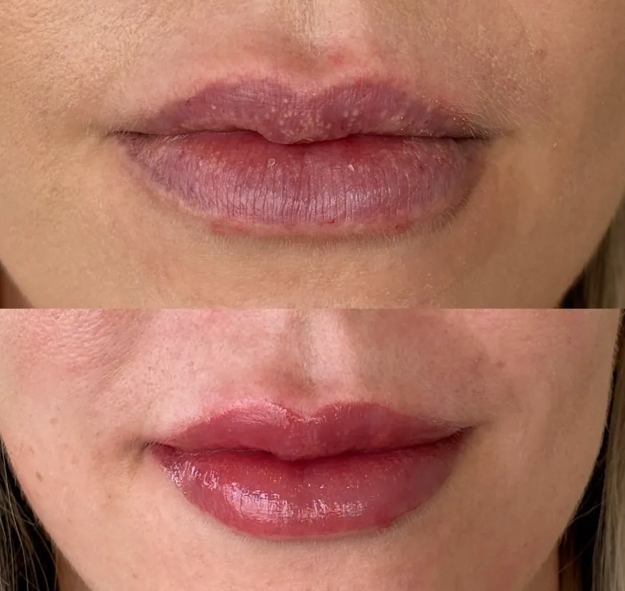 How Lip Tattoos Can Enhance Your Natural Beauty