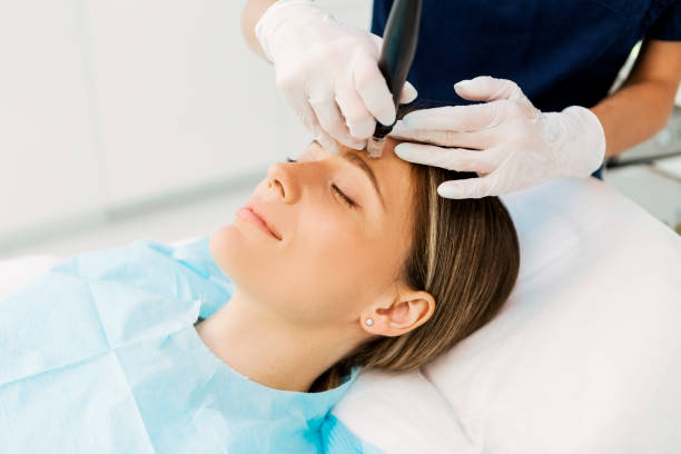 Is it normal to sweat after microneedling? Learn about post-treatment effects and their significance.