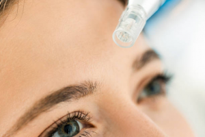When to Exercise After Microneedling: Optimal Timing for Post-Treatment Workouts